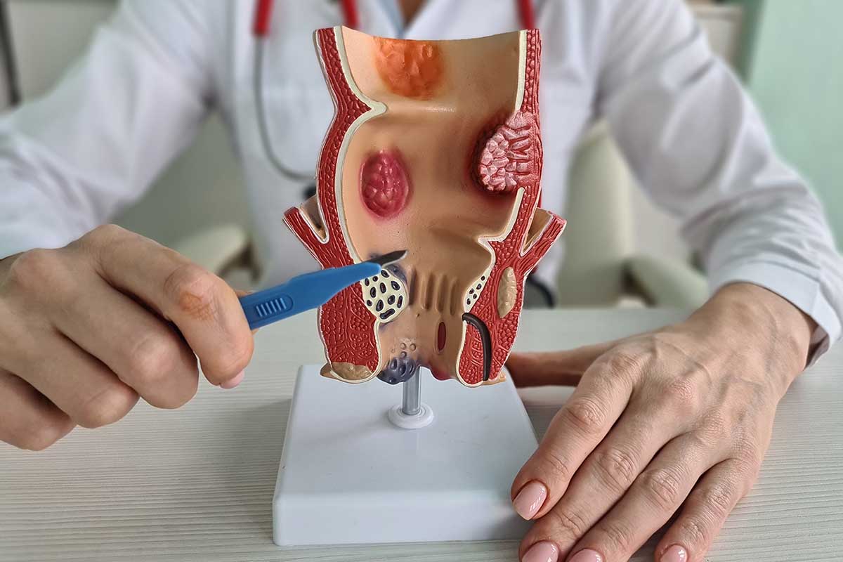 Proctologista em Manhuaçu  MG
